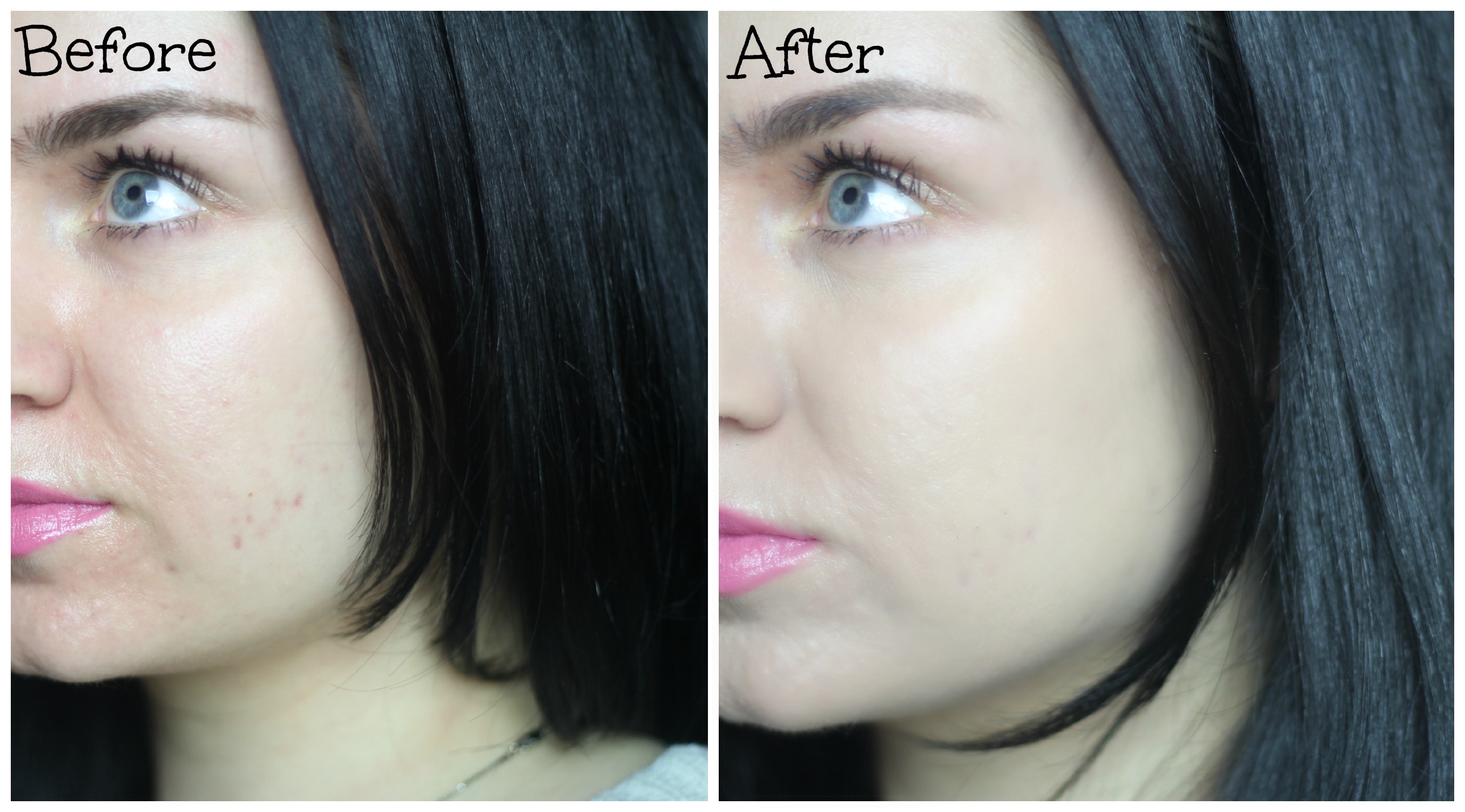 before and after BB cream – THIRTEEN THOUGHTS